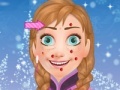 Παιχνίδι Anna: Face clean