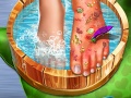 Παιχνίδι Feet Skin Doctor