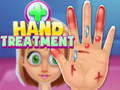 Παιχνίδι Hand Treatment