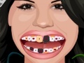 Παιχνίδι Selena Gomez Perfect Teeth 